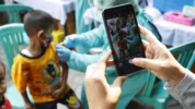 Lonjakan kasus campak di Indonesia