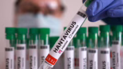 Lonjakan kasus hantavirus di Argentina