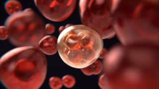 tanda awal kanker pankreas